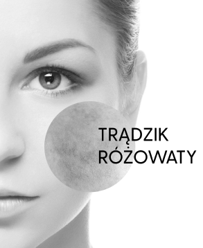https://www.zdrowaskora.pl/zdrowa-skora-azs/